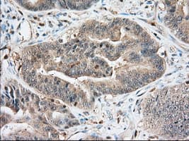 IGF2BP2 Antibody (clone OTI4C4, Carrier-free)