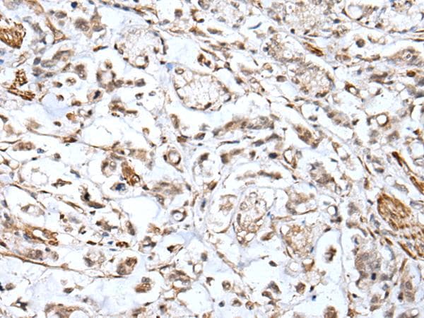 HSPB1 / HSP27 Antibody