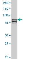 Monoclonal Mouse anti-Human MTA1 Antibody (clone 4D5, WB)