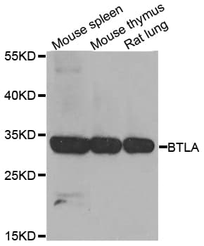 BTLA / CD272 Antibody