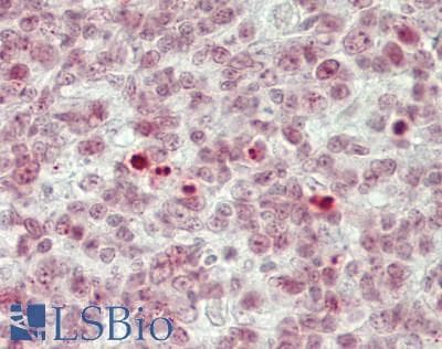 IHC-plus™ Polyclonal Rabbit anti-Human BCL11B Antibody (aa850-C-term, IHC)