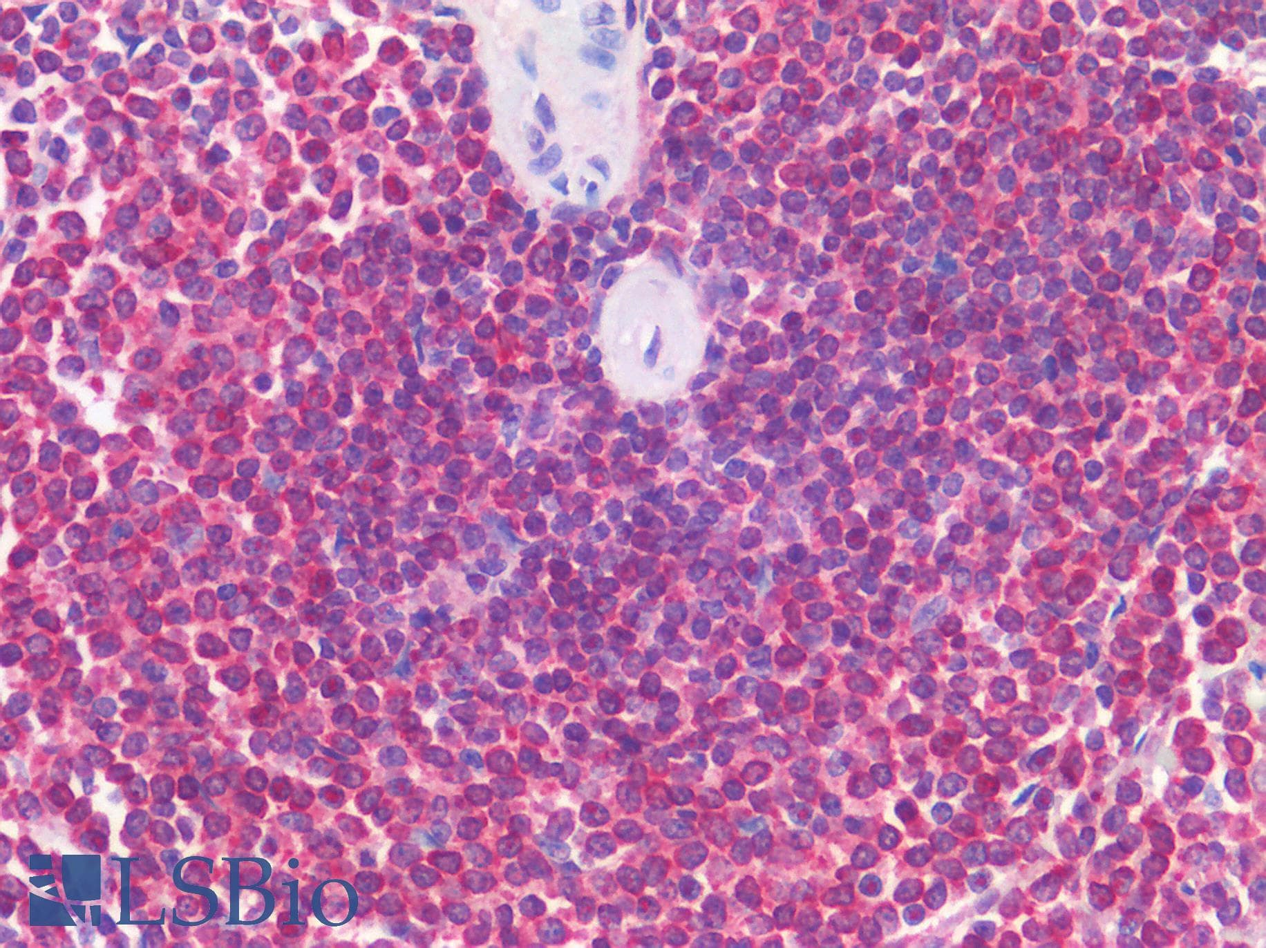 IHC-plus™ AML1 / RUNX1 Antibody