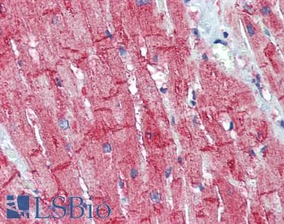 IHC-plus™ SLC8A1 / NCX1 Antibody