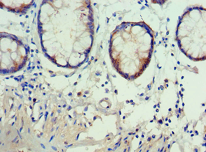 Polyclonal Rabbit anti-Human AKAP5 / AKAP79 Antibody (aa1-270, IHC)