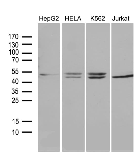 Monoclonal Mouse anti-Human RRM2 Antibody (clone OTI1F2, IHC, WB)