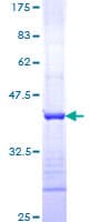 Human ST14 / Matriptase Protein (Recombinant GST, N-terminus)