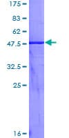 Human KLK2 / Kallikrein 2 Protein (Recombinant GST)