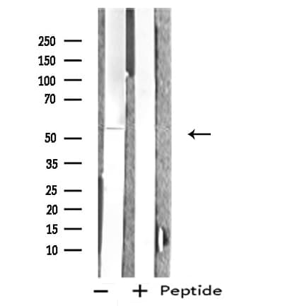 INA / Alpha Internexin Antibody