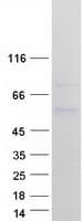 Human HERPUD1 / HERP Protein (Recombinant Myc-DDK (Flag))
