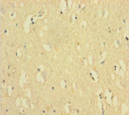 FANCD2 Antibody