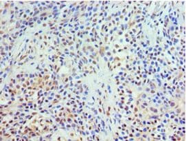 Polyclonal Rabbit anti-Human TXNRD2 Antibody (aa100-310, IHC, WB)