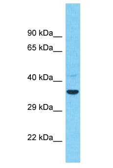 TMEM26 Antibody (aa316-365)