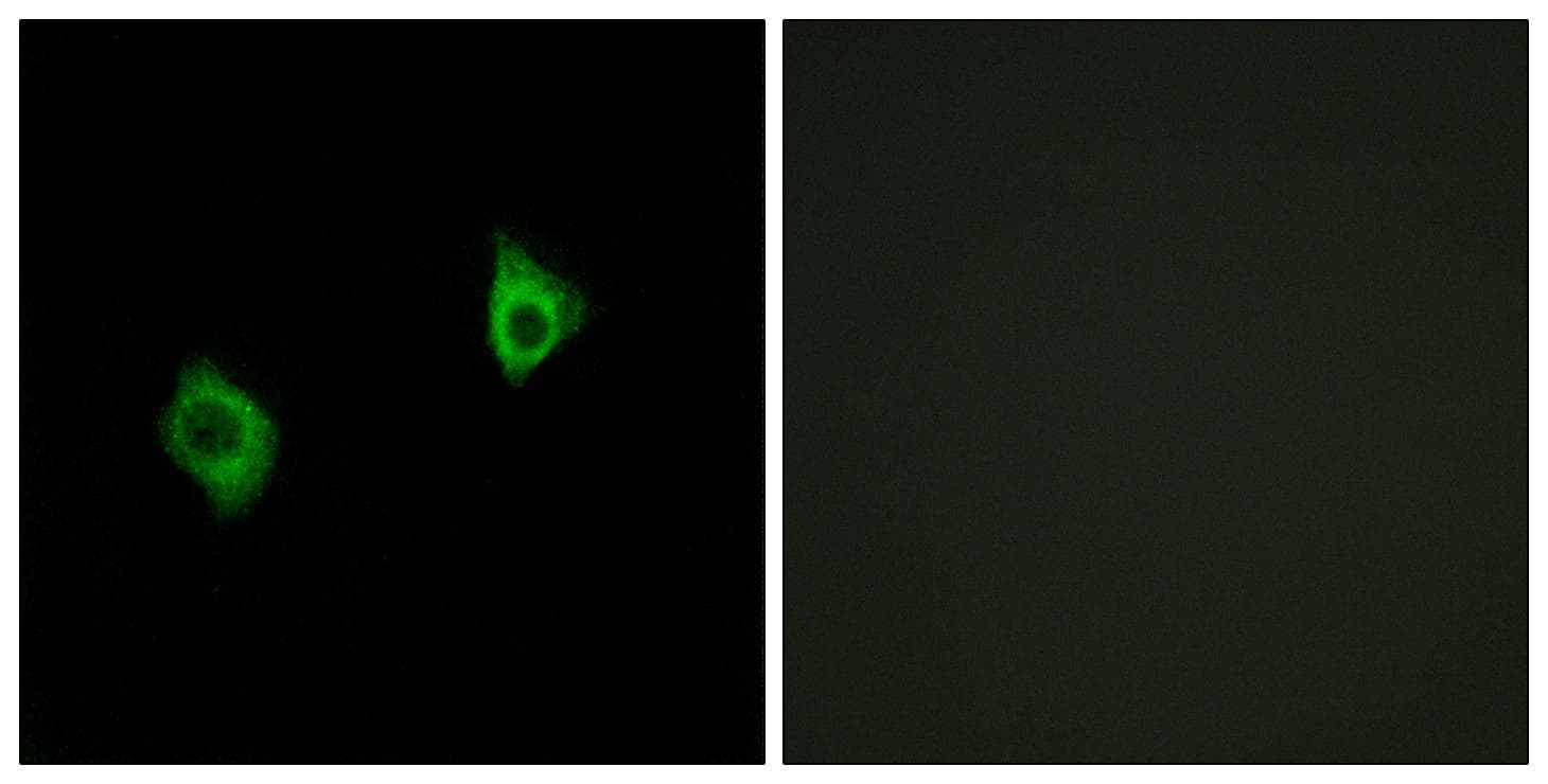 RPS9 / Ribosomal Protein S9 Antibody