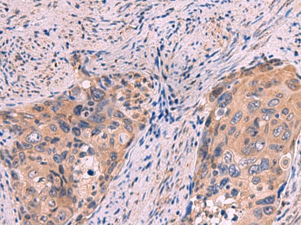 PPEF / PPEF1 Antibody