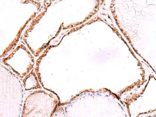 LMCD1 Antibody