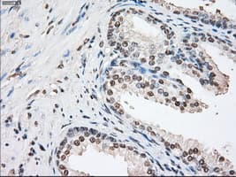 FKBP5 / FKBP51 Antibody (clone OTI3E9)