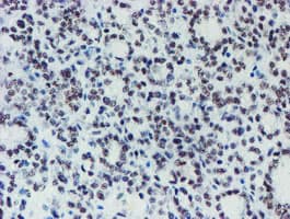 METTL16 / METT10D Antibody (clone OTI3B5)