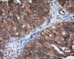 HMRF1L / MTRF1L Antibody (clone OTI1C5)