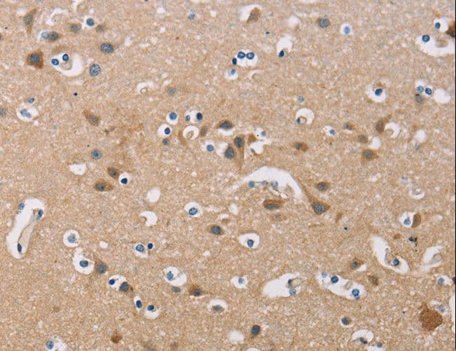 FXYD1 / Phospholemman Antibody
