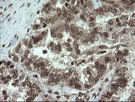 PCDH7 Antibody (clone OTI1F7)