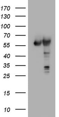 PKM2 Antibody (clone OTI12D5, Carrier-free)
