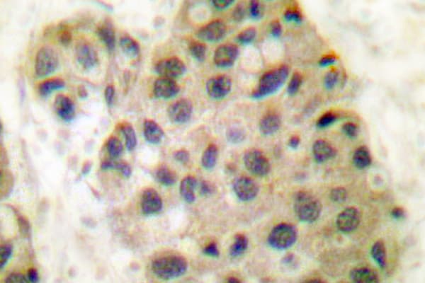 MCM3AP / GANP Antibody (Glu1872)