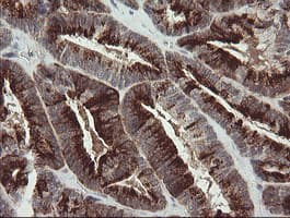 SLA2 / SLAP2 Antibody (clone OTI4A11)