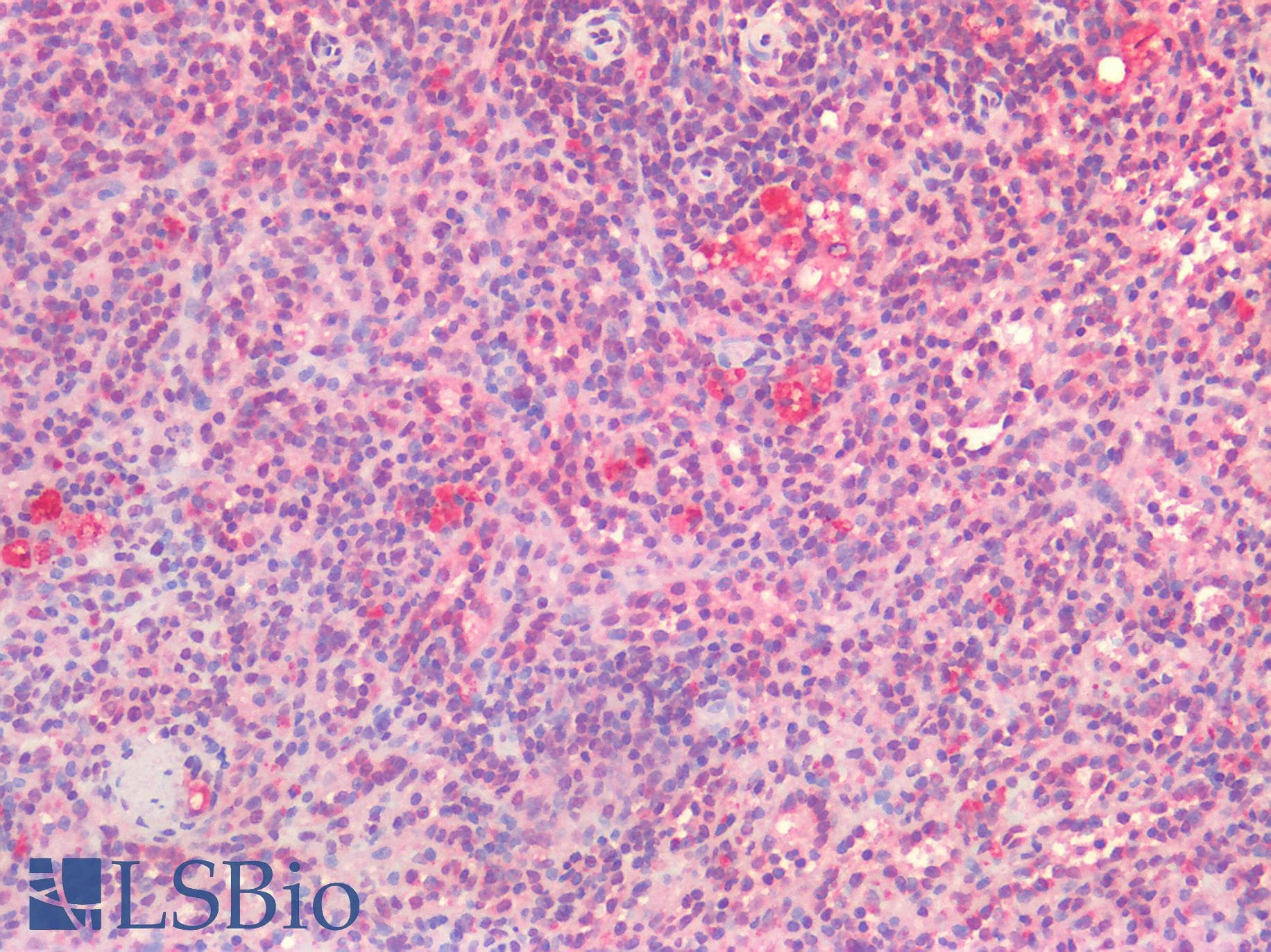 IHC-plus™ Polyclonal Rabbit anti-Human HDAC6 Antibody (IHC)