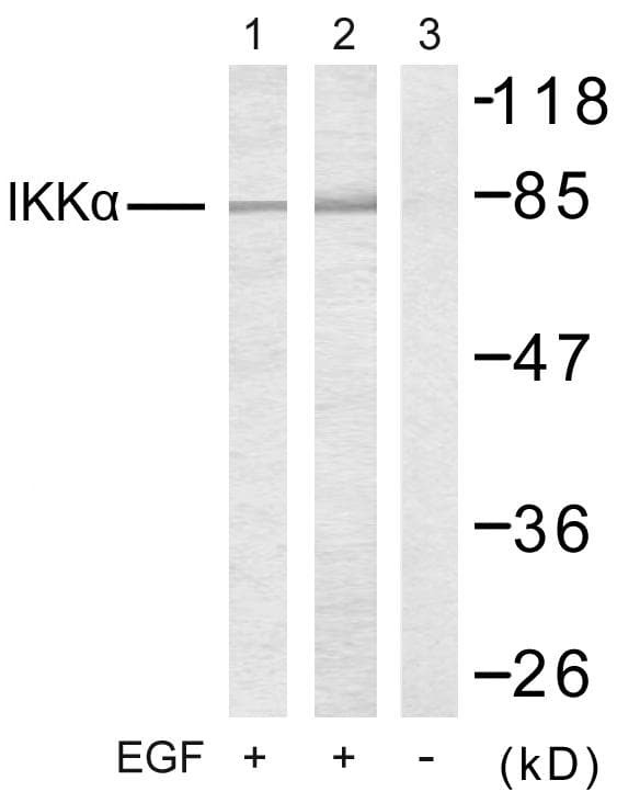 Polyclonal Rabbit anti-Human CHUK / IKKA / IKK Alpha Antibody (p23, IHC, WB)