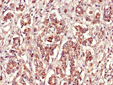 FBXL22 Antibody