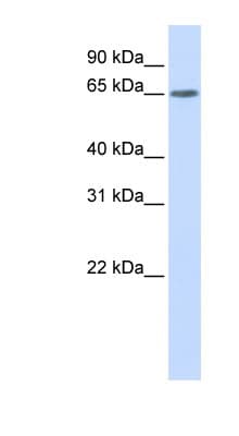 Polyclonal Rabbit anti-Human YTHDF3 Antibody (aa108-157, WB)