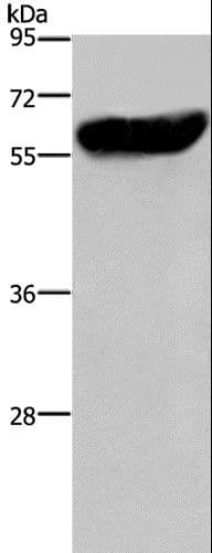 CYP2E1 Antibody