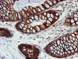 Monoclonal Mouse anti-Human FXYD3 Antibody (clone OTI1E8, IHC, IF, WB)