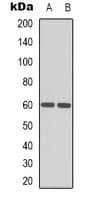HEXA Antibody (Internal)