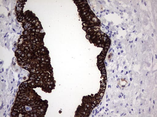 Monoclonal Mouse anti-Human KRT19 / CK19 / Cytokeratin 19 Antibody (clone OTI5H6, aa240-390, IHC, WB)