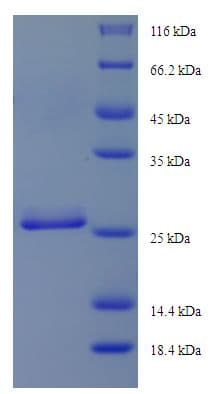 Human DYNLRB1 Protein (Recombinant His-SUMO)