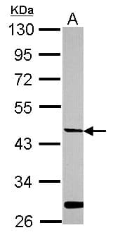HPN / TMPRSS1 / Hepsin Antibody