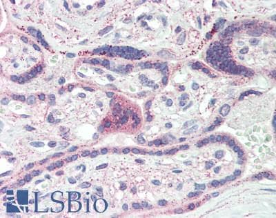 IHC-plus™ Monoclonal Mouse anti-Human PD-L2 / PDCD1LG2 / CD273 Antibody (clone 7C7, IHC, IF, WB)