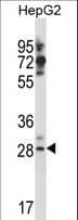 Polyclonal Rabbit anti-Human GSG1L Antibody (aa232-261, IHC, WB)