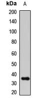 IGFBP2 / IGF-BP53 Antibody
