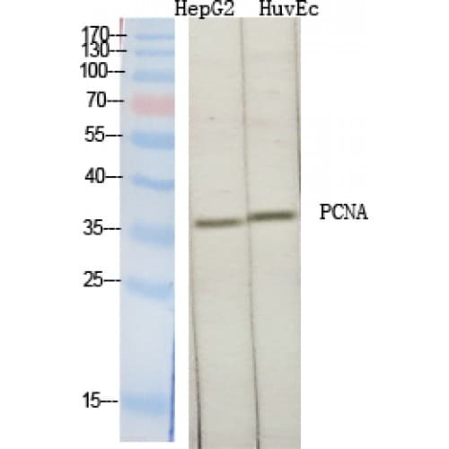 Polyclonal Rabbit anti-Human PCNA Antibody (30-110 aa, Internal, IHC, WB)