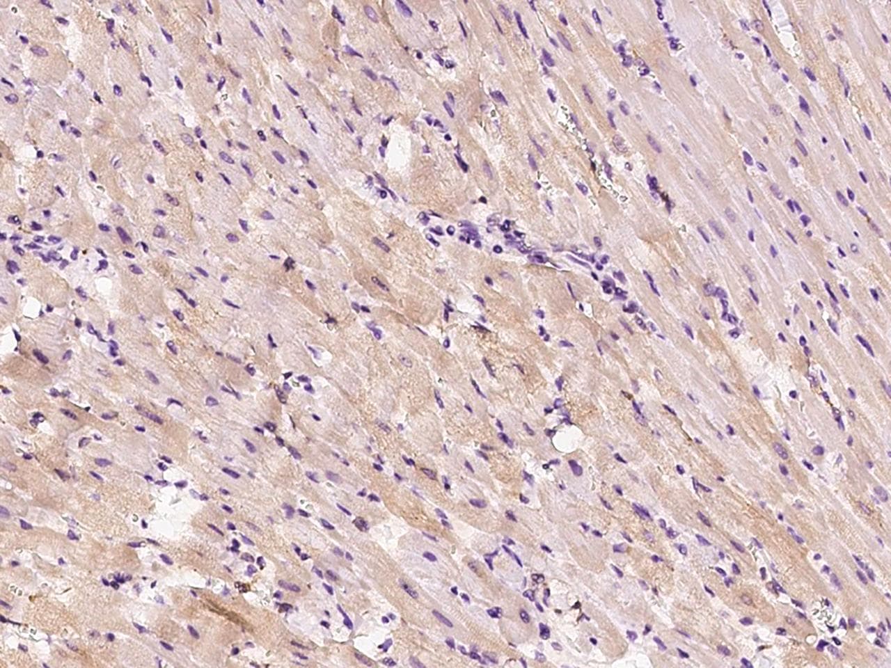 HSPB8 / H11 / HSP22 Antibody