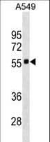 SCARB1 / SR-BI Antibody (aa72-101)