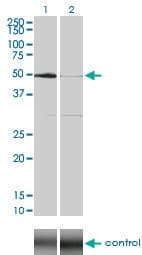 SGK1 / SGK Antibody (clone 4D7-G3)