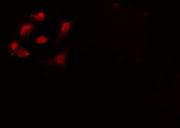 Polyclonal Rabbit anti-Human CSTF2 / CstF-64 Antibody (IF, WB)