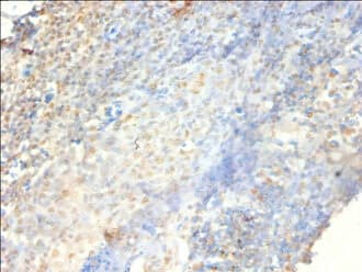 Polyclonal Rabbit anti-Human PSME3 Antibody (IHC, WB)