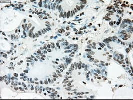 ERCC1 Antibody (clone OTI1A3)