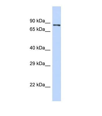 PIEZO2 / FAM38B Antibody (aa162-211)
