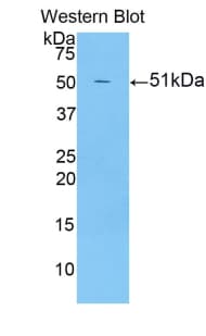 LRG1 / LRG Antibody (aa136-342)