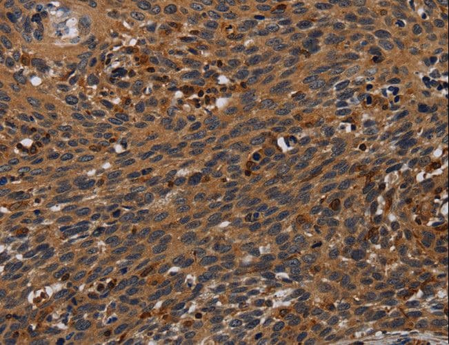 PCDHB15 Antibody